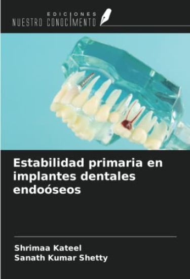 Estabilidad primaria en implantes dentales endoóseos