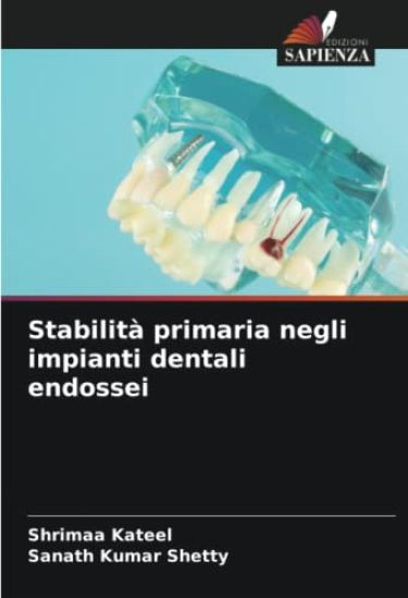 Stabilità primaria negli impianti dentali endossei