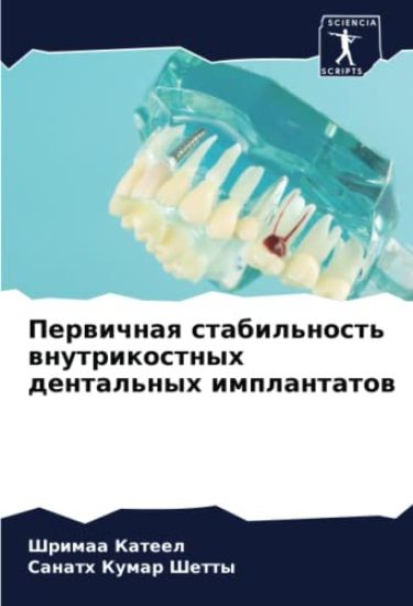 Perwichnaq stabil'nost' wnutrikostnyh dental'nyh implantatow