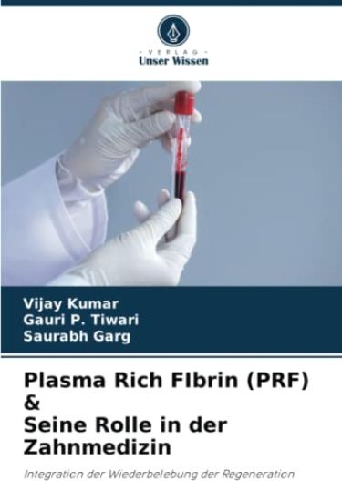 Plasma Rich FIbrin (PRF) & Seine Rolle in der Zahnmedizin