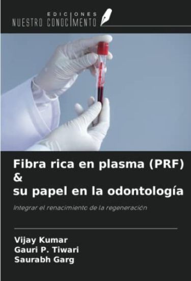 Fibra rica en plasma (PRF) & su papel en la odontología