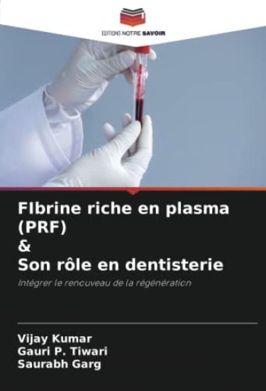 FIbrine riche en plasma (PRF) & Son rôle en dentisterie