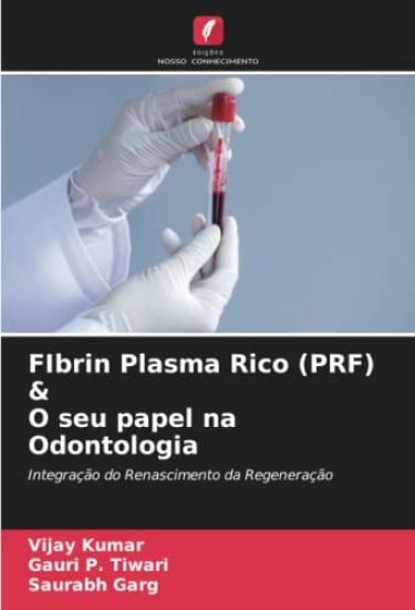 FIbrin Plasma Rico (PRF) & O seu papel na Odontologia