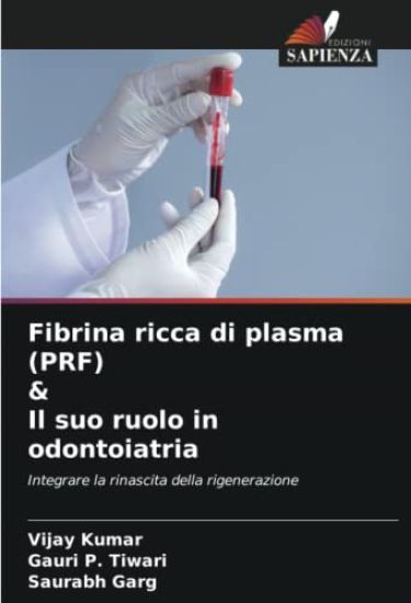 Fibrina ricca di plasma (PRF) & Il suo ruolo in odontoiatria