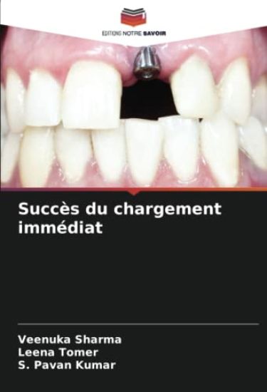 Succès du chargement immédiat
