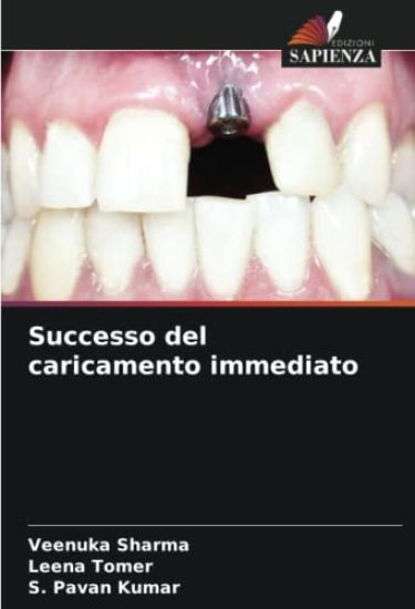 Successo del caricamento immediato