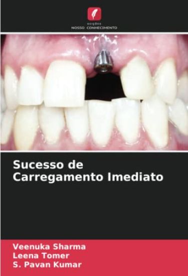 Sucesso de Carregamento Imediato