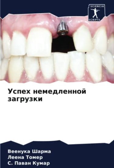 Uspeh nemedlennoj zagruzki