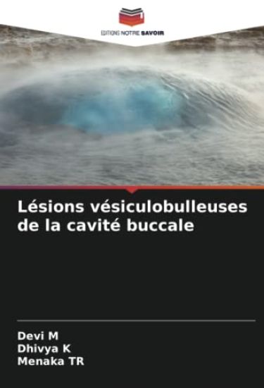 Lésions vésiculobulleuses de la cavité buccale