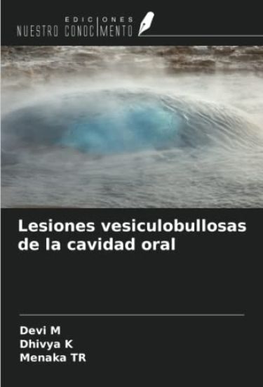 Lesiones vesiculobullosas de la cavidad oral