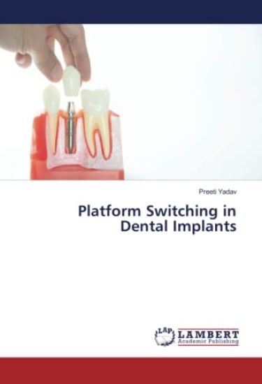 Platform Switching in Dental Implants