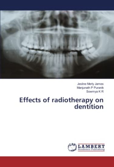 Effects of radiotherapy on dentition