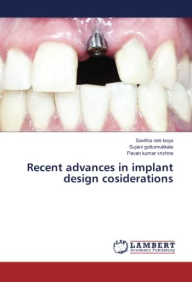 Recent advances in implant design cosiderations