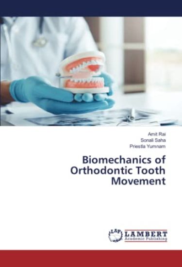 Biomechanics of Orthodontic Tooth Movement