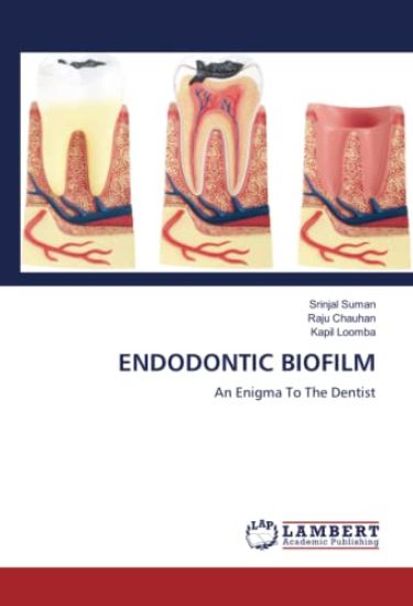 ENDODONTIC BIOFILM