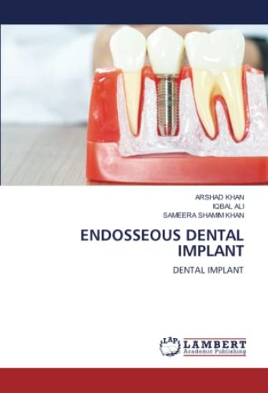 ENDOSSEOUS DENTAL IMPLANT