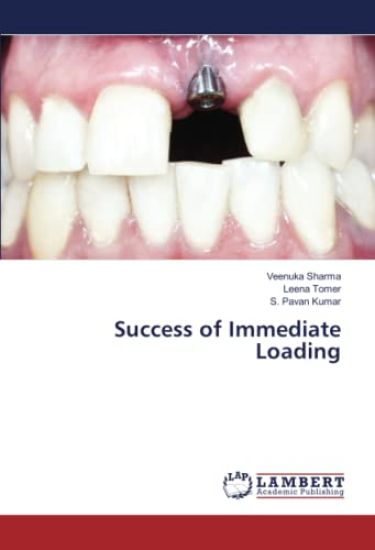 Success of Immediate Loading