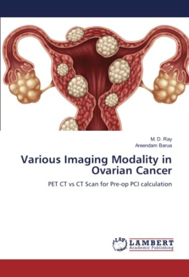 Various Imaging Modality in Ovarian Cancer