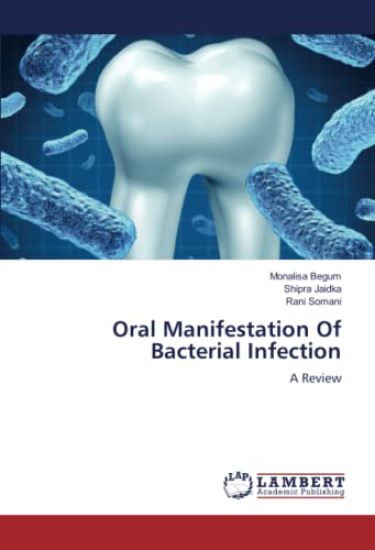 Oral Manifestation Of Bacterial Infection