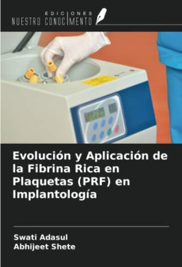 Evolución y Aplicación de la Fibrina Rica en Plaquetas (PRF) en Implantología