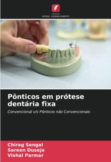 Pônticos em prótese dentária fixa