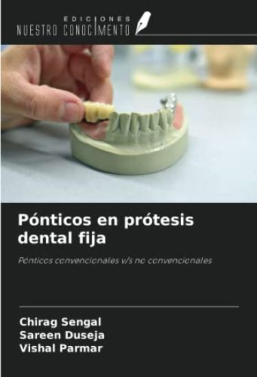 Pónticos en prótesis dental fija