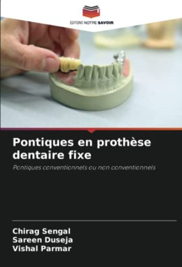 Pontiques en prothèse dentaire fixe