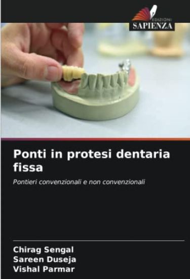 Ponti in protesi dentaria fissa