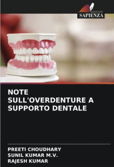 NOTE SULL'OVERDENTURE A SUPPORTO DENTALE