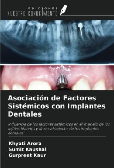 Asociación de Factores Sistémicos con Implantes Dentales