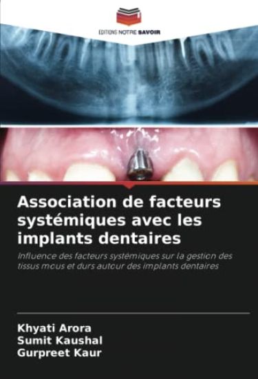 Association de facteurs systémiques avec les implants dentaires