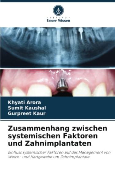 Zusammenhang zwischen systemischen Faktoren und Zahnimplantaten