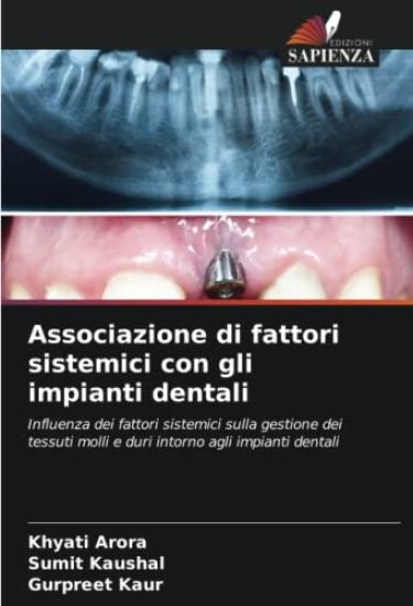 Associazione di fattori sistemici con gli impianti dentali