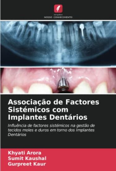 Associação de Factores Sistémicos com Implantes Dentários