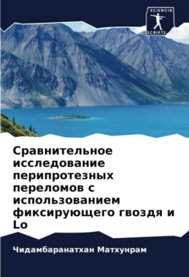 Srawnitel'noe issledowanie periproteznyh perelomow s ispol'zowaniem fixiruüschego gwozdq i Lo
