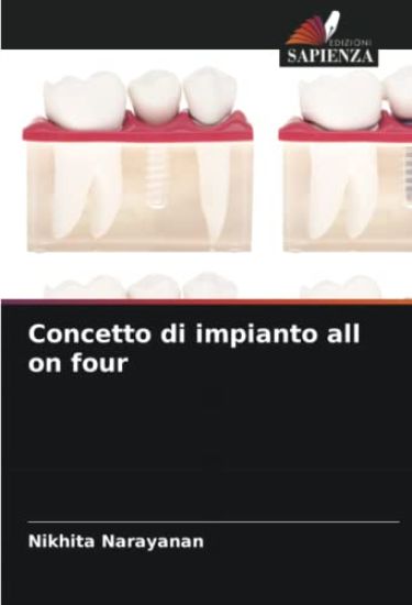 Concetto di impianto all on four