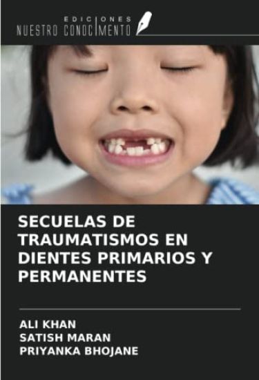 SECUELAS DE TRAUMATISMOS EN DIENTES PRIMARIOS Y PERMANENTES