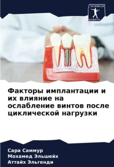 Faktory implantacii i ih wliqnie na oslablenie wintow posle ciklicheskoj nagruzki