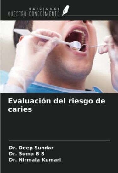 Evaluación del riesgo de caries