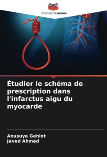 Étudier le schéma de prescription dans l'infarctus aigu du myocarde