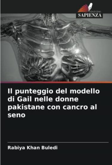 Il punteggio del modello di Gail nelle donne pakistane con cancro al seno
