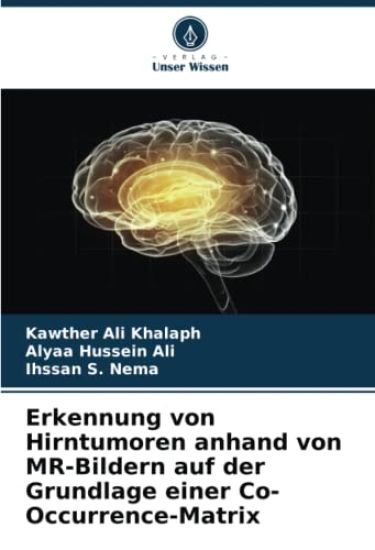 Erkennung von Hirntumoren anhand von MR-Bildern auf der Grundlage einer Co-Occurrence-Matrix