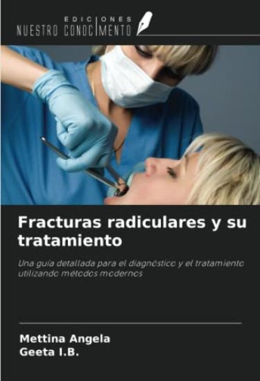 Fracturas radiculares y su tratamiento