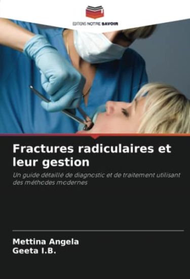 Fractures radiculaires et leur gestion