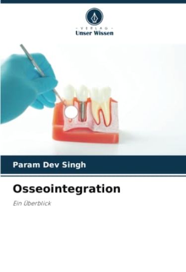 Osseointegration