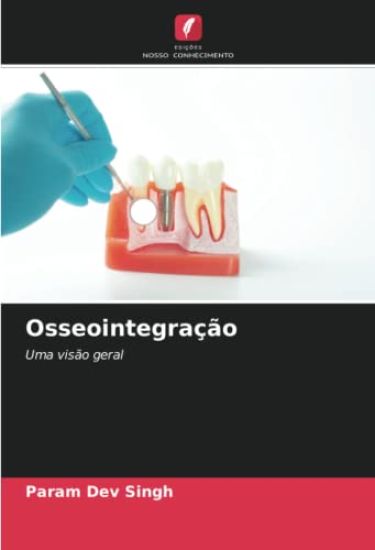 Osseointegração