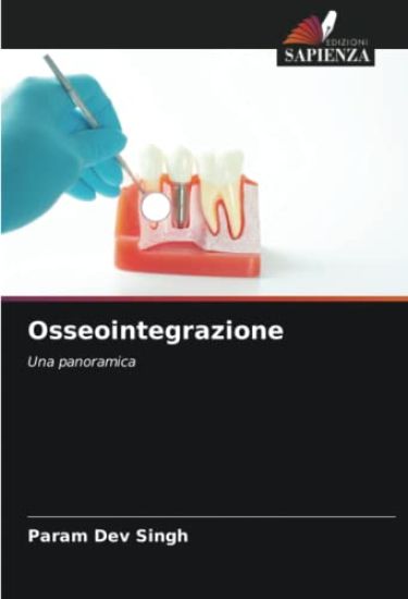 Osseointegrazione