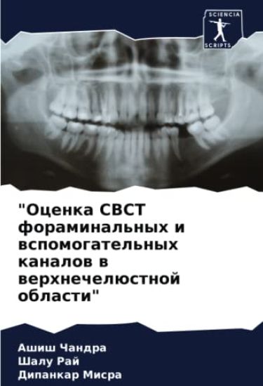 "Ocenka CBCT foraminal'nyh i wspomogatel'nyh kanalow w werhnechelüstnoj oblasti"