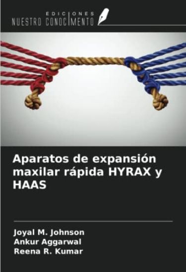 Aparatos de expansión maxilar rápida HYRAX y HAAS