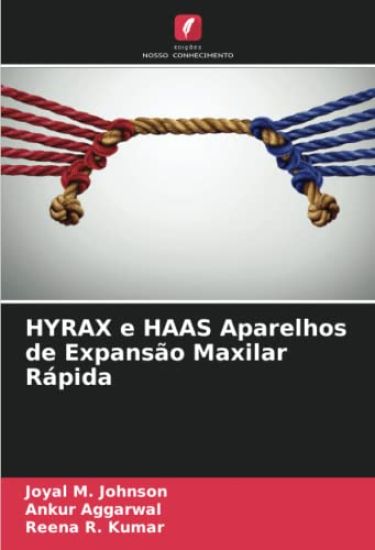 HYRAX e HAAS Aparelhos de Expansão Maxilar Rápida